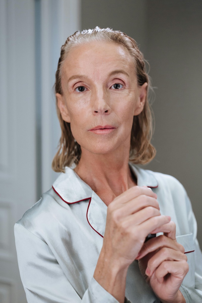 Botox Düsseldorf vorher — Mimikfalten Stirn und Krähenfüße, typische Botulinumtoxin-Indikation bei Dr. Fetai