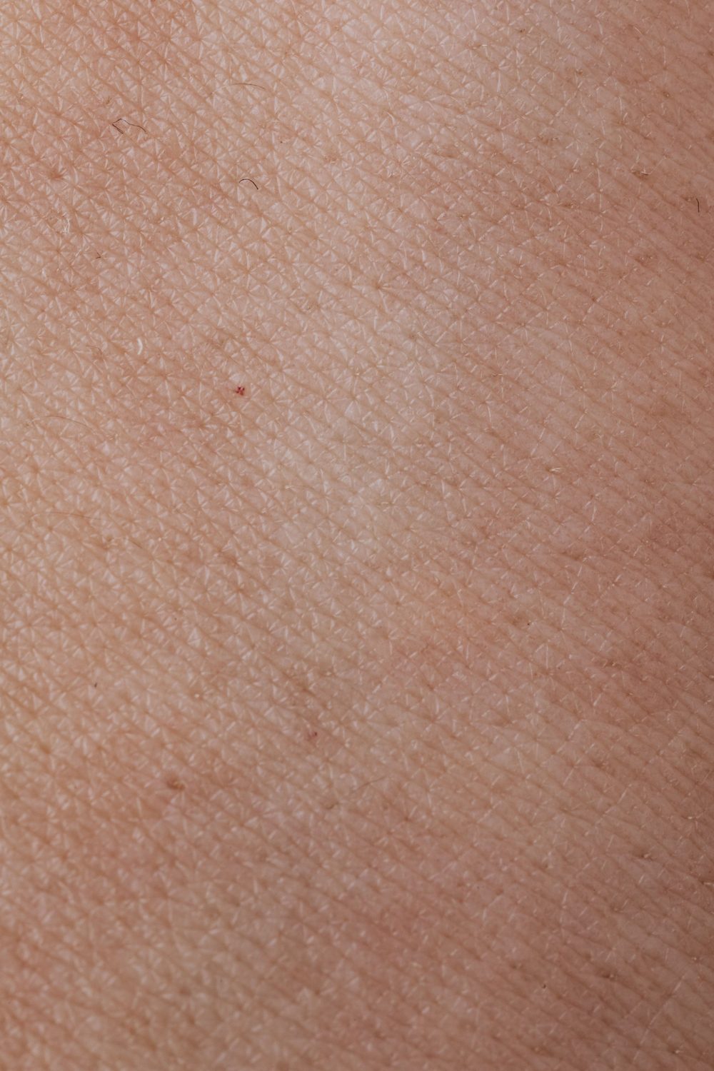 Wartebereich Body Art Surgery Institute Düsseldorf — Sculptra beim Facharzt Dr. (univ.Te.) Fetai